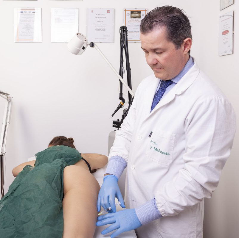Mesoterapia per PEFS e gonfiore dei tessuti